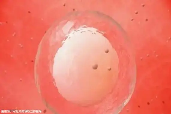 柬埔寨第三方辅助生殖单周期多少钱